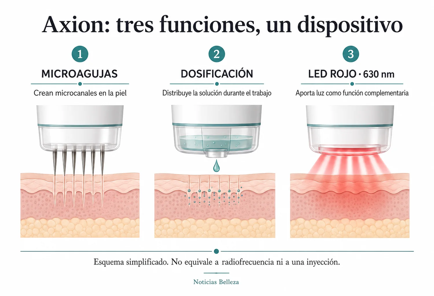 Infografía de axion: microagujas, dispensación de solución y luz LED roja de 630 nm